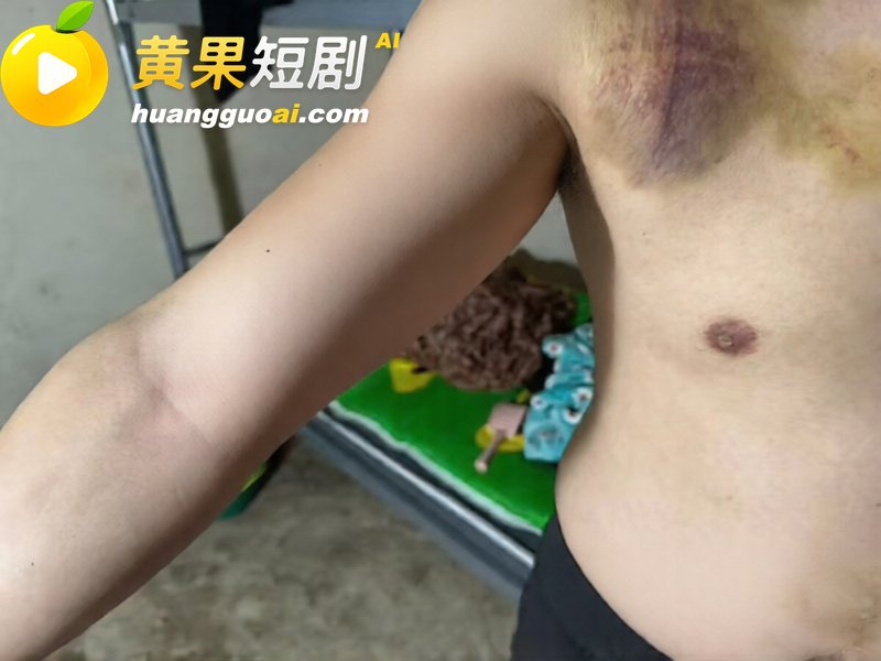 泰国失联转缅甸园区 穆昌俊遭暴打